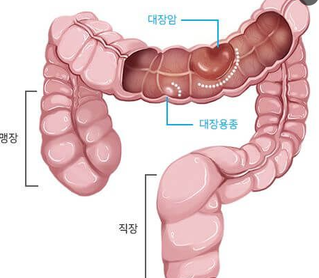 1339-건강 5 사진 2.png