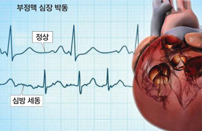 1354-건강 2 사진 2.png
