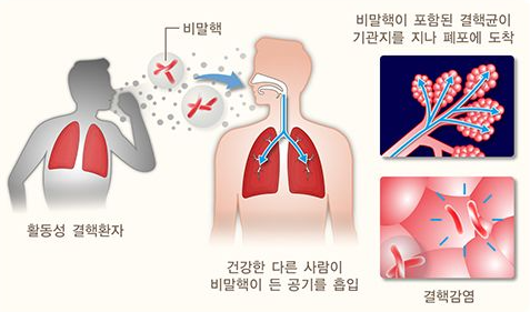 1336-건강 2 사진 4.png