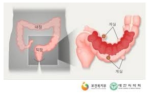 911-건강 3 사진.JPG