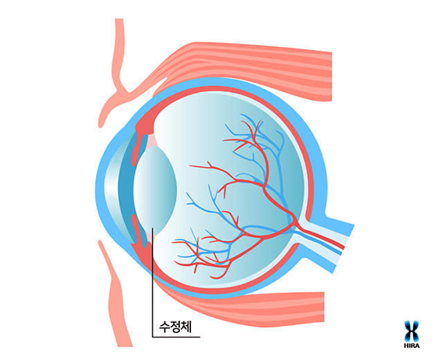 1171-건강 2 사진 3.jpg