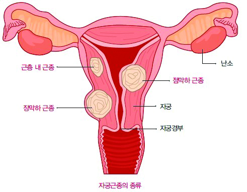 21- 1015-여성 1 사진.jpg