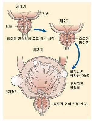 1059-건강 1 사진 2.png