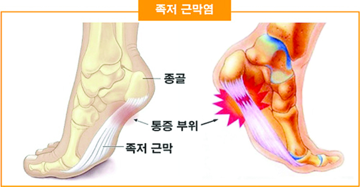 34- 건강 1 사진.jpg