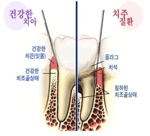 973-건강 2 사진.png