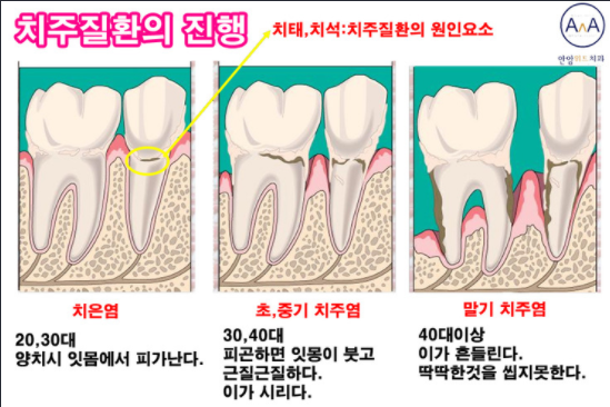 1088-여성 1 사진.png