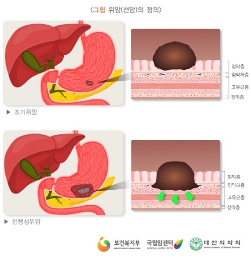 1185-건강 2 사진.jpg