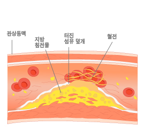 926-건강 4 사진.jpg