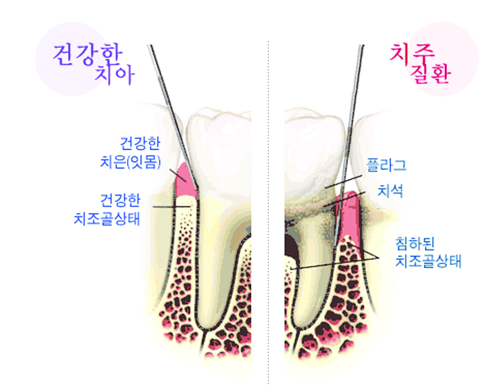 34-건강 2 사진.jpg