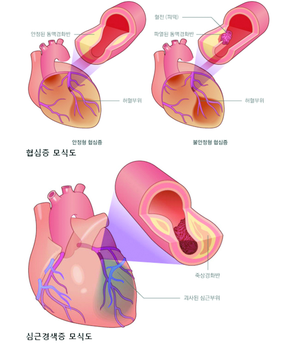 34-건강 3 사진.jpg