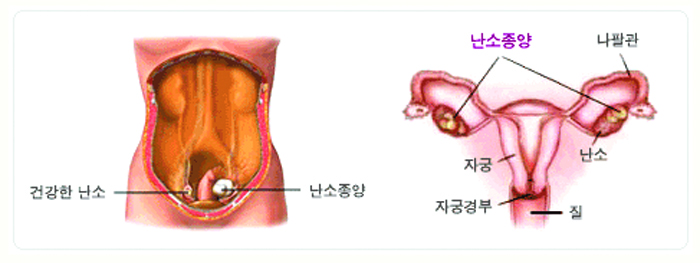 21- 1020-여성 2 사진.jpg