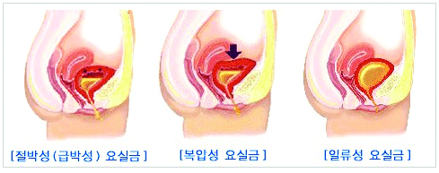 32- 1013-건강 1 사진.jpg