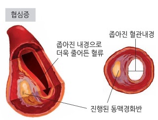 985-건강 1 사진.jpg