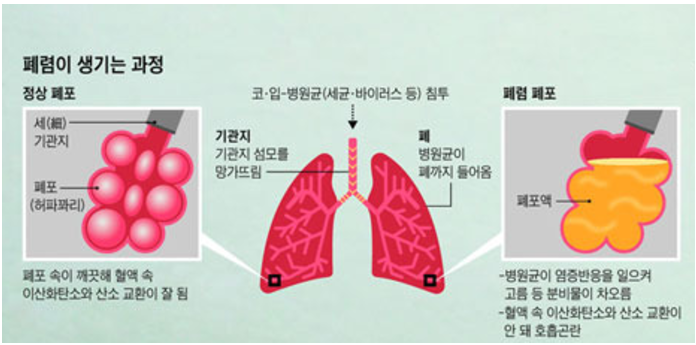 1091-건강 1 사진 3.png