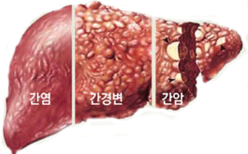 855-건강 3 ekn 사진.jpg