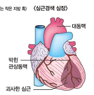 1229-건강 09 사진 1.png