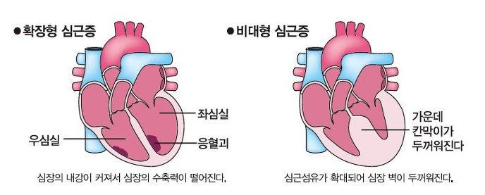 1229-건강 09 사진 2.png