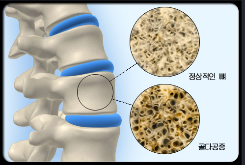 1091-여성 2 사진 2.png