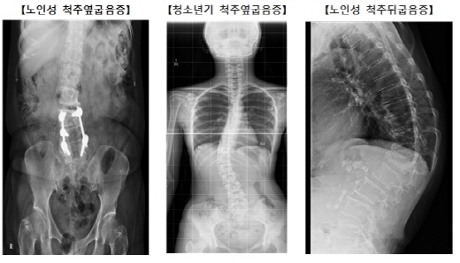 938-건강 4 사진.jpg