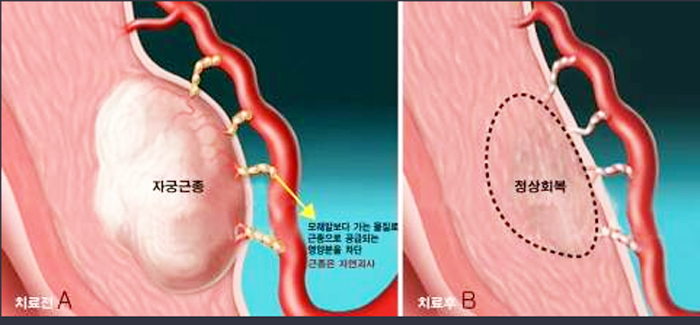 1050-여성 2 사진.jpg