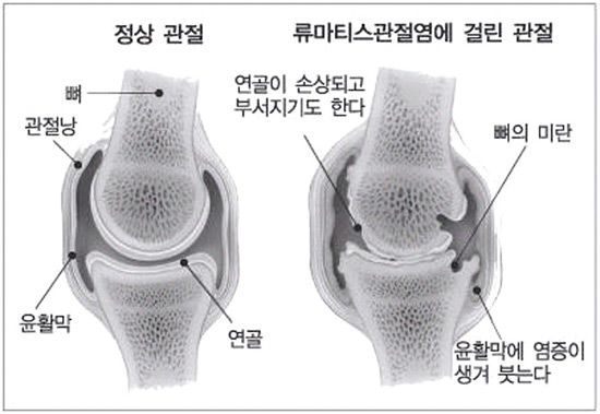 987-건강 2 사진.jpg