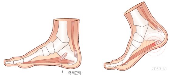 951-건강 1 사진.jpg