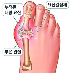 1023-건강 2 사진 1.jpg