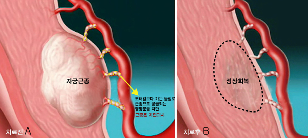 959-여성 2 사진.jpg