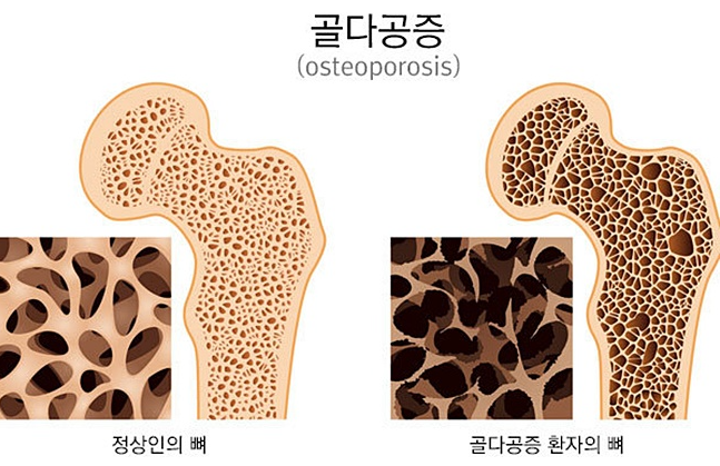 1233-여성 1 사진.png