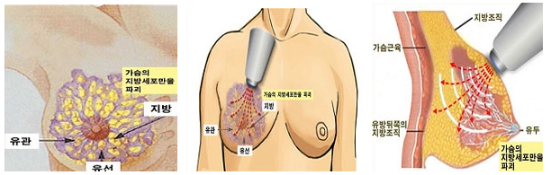 1140-여성 1 사진(3 개중 가운데 제외).png