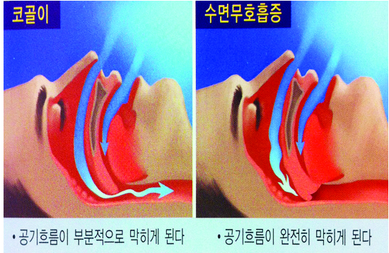 1039-건강 3 사진 2 상의할 것.jpg