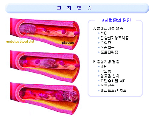 1039-건강 5 사진.jpg