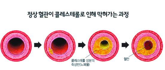 1039-건강 5 사진 2.jpg