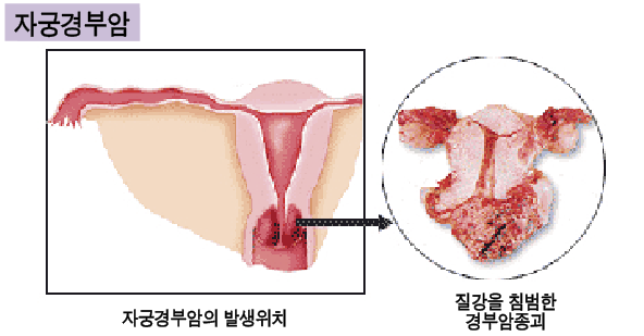 여성1-.PNG