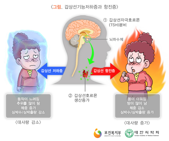 1079-여성 2 사진.jpg