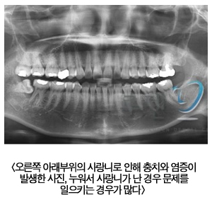 867-건강 4 사진.jpg