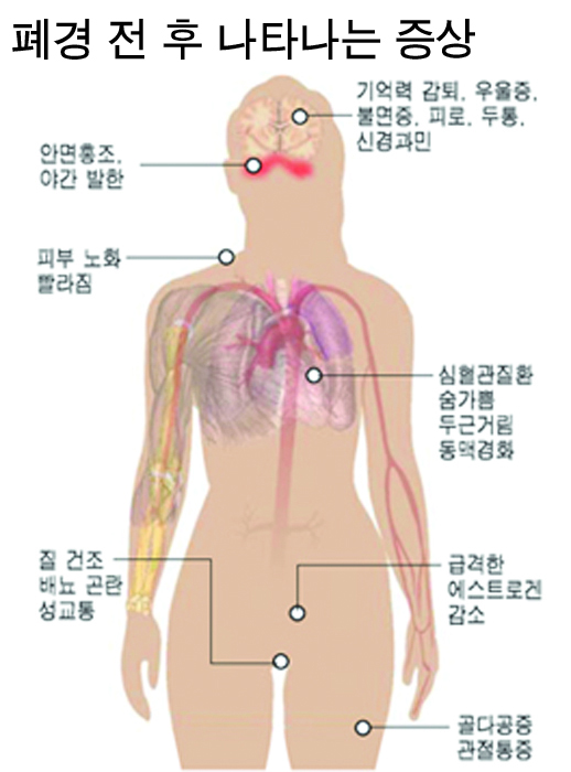 12-여성 3 사진.jpg