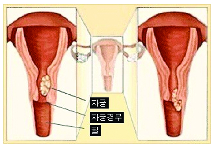 12- 여성 1 사진.jpg