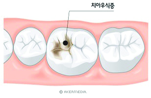 1077-건강 1 사진.jpg