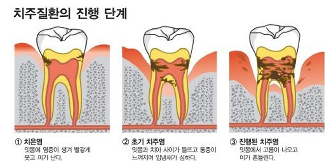 1046-건강 3 사진 1.png