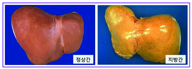 1072-건강 2 사진 2.jpg