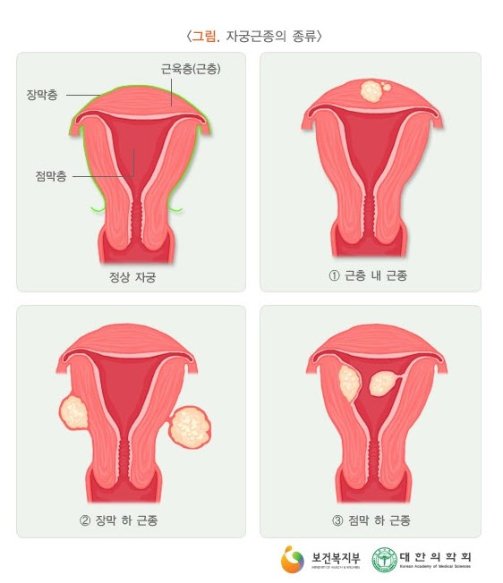 935-여성 1 사진.jpg