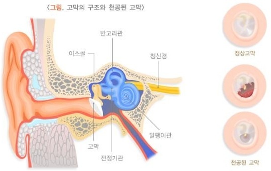 998-건강 1 사진.jpg