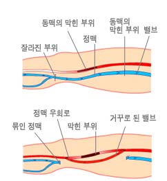 832-건강 1 ekn 사진.jpg