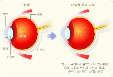 921-건강 2 사진.jpg