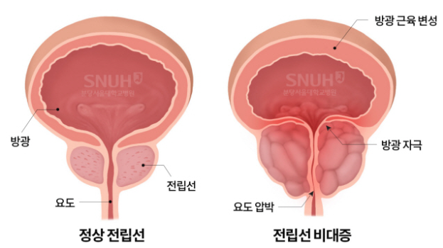 1290-건강 2 사진.png